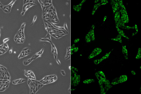 MDCK mx1-GFP 细胞相差/荧光图像