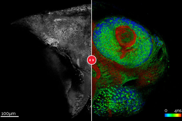 野生斑马鱼胚胎的自发荧光多光子成像