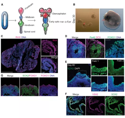 徕卡共聚焦助力人脑类器官研究新突破——迷你大脑长眼睛了