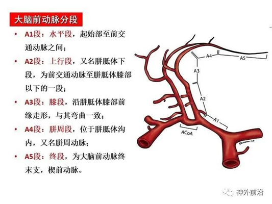徕卡神刀博览第60期|天坛医院王磊：累及双侧额叶巨大胶质瘤手术 如何寻找边界和保护血管